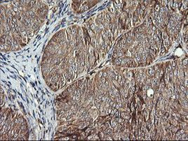 ACAA2 Antibody in Immunohistochemistry (Paraffin) (IHC (P))