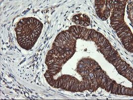 ACAA2 Antibody in Immunohistochemistry (Paraffin) (IHC (P))