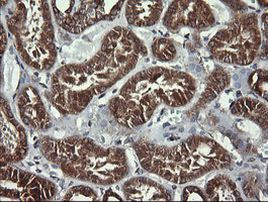 ACAA2 Antibody in Immunohistochemistry (Paraffin) (IHC (P))