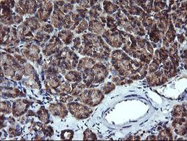 ACAA2 Antibody in Immunohistochemistry (Paraffin) (IHC (P))