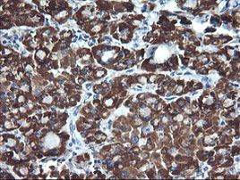 ACAA2 Antibody in Immunohistochemistry (Paraffin) (IHC (P))