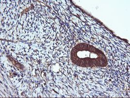 ACAA2 Antibody in Immunohistochemistry (Paraffin) (IHC (P))