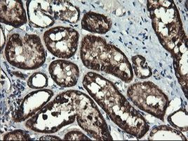 ACAA2 Antibody in Immunohistochemistry (Paraffin) (IHC (P))