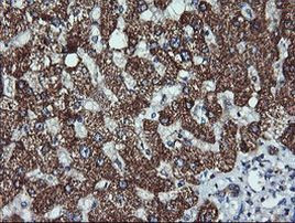 ACAA2 Antibody in Immunohistochemistry (Paraffin) (IHC (P))