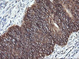 ACAA2 Antibody in Immunohistochemistry (Paraffin) (IHC (P))