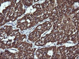 ACAA2 Antibody in Immunohistochemistry (Paraffin) (IHC (P))