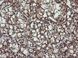 ACAA2 Antibody in Immunohistochemistry (Paraffin) (IHC (P))