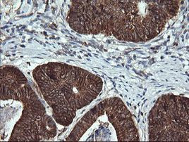 ACAA2 Antibody in Immunohistochemistry (Paraffin) (IHC (P))