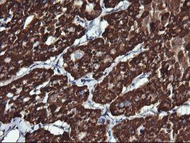 ACAA2 Antibody in Immunohistochemistry (Paraffin) (IHC (P))