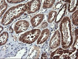 ACAA2 Antibody in Immunohistochemistry (Paraffin) (IHC (P))