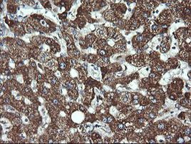 ACAA2 Antibody in Immunohistochemistry (Paraffin) (IHC (P))