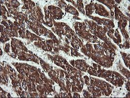 ACAA2 Antibody in Immunohistochemistry (Paraffin) (IHC (P))