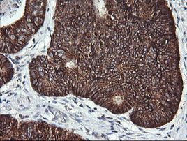 ACAA2 Antibody in Immunohistochemistry (Paraffin) (IHC (P))