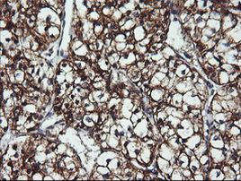 ACAA2 Antibody in Immunohistochemistry (Paraffin) (IHC (P))