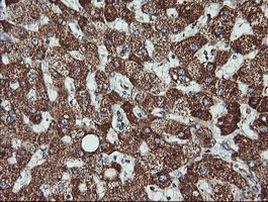 ACAA2 Antibody in Immunohistochemistry (Paraffin) (IHC (P))