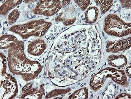 ACAA2 Antibody in Immunohistochemistry (Paraffin) (IHC (P))