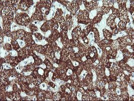 ACAA2 Antibody in Immunohistochemistry (Paraffin) (IHC (P))