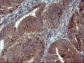 ACAA2 Antibody in Immunohistochemistry (Paraffin) (IHC (P))