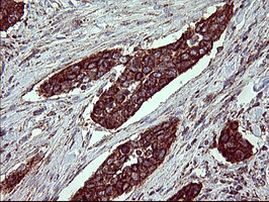 ACAA2 Antibody in Immunohistochemistry (Paraffin) (IHC (P))