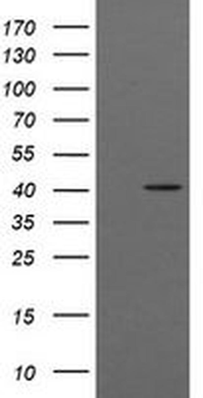 ACAA2 Antibody in Western Blot (WB)