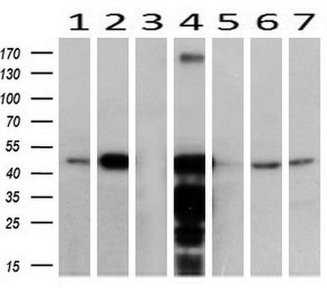 ACAA2 Antibody in Western Blot (WB)