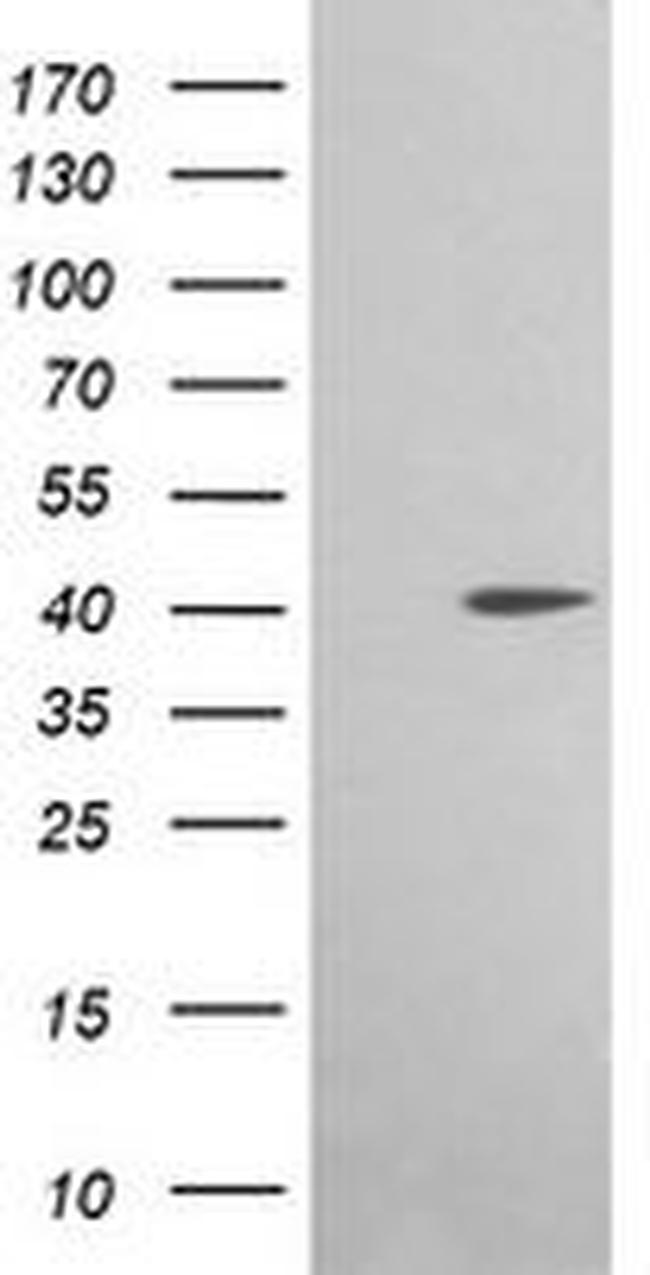 ACAA2 Antibody in Western Blot (WB)