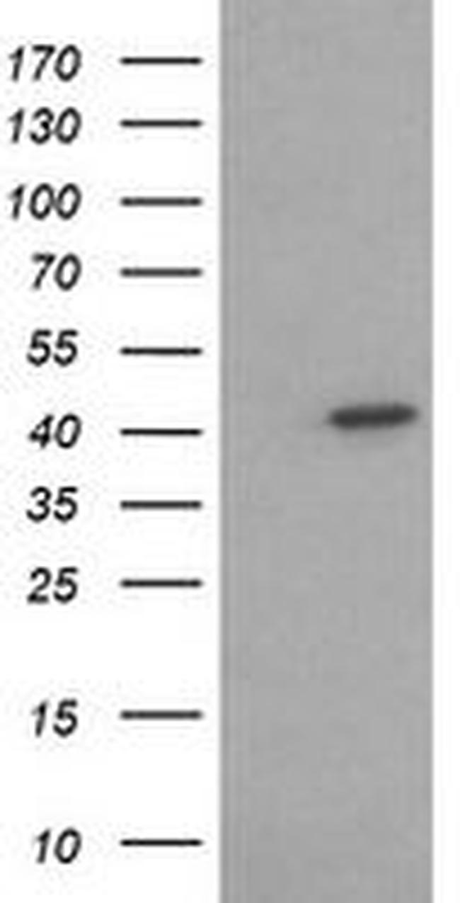 ACAA2 Antibody in Western Blot (WB)