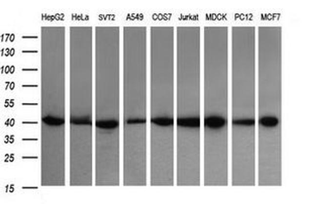 ACAA2 Antibody in Western Blot (WB)