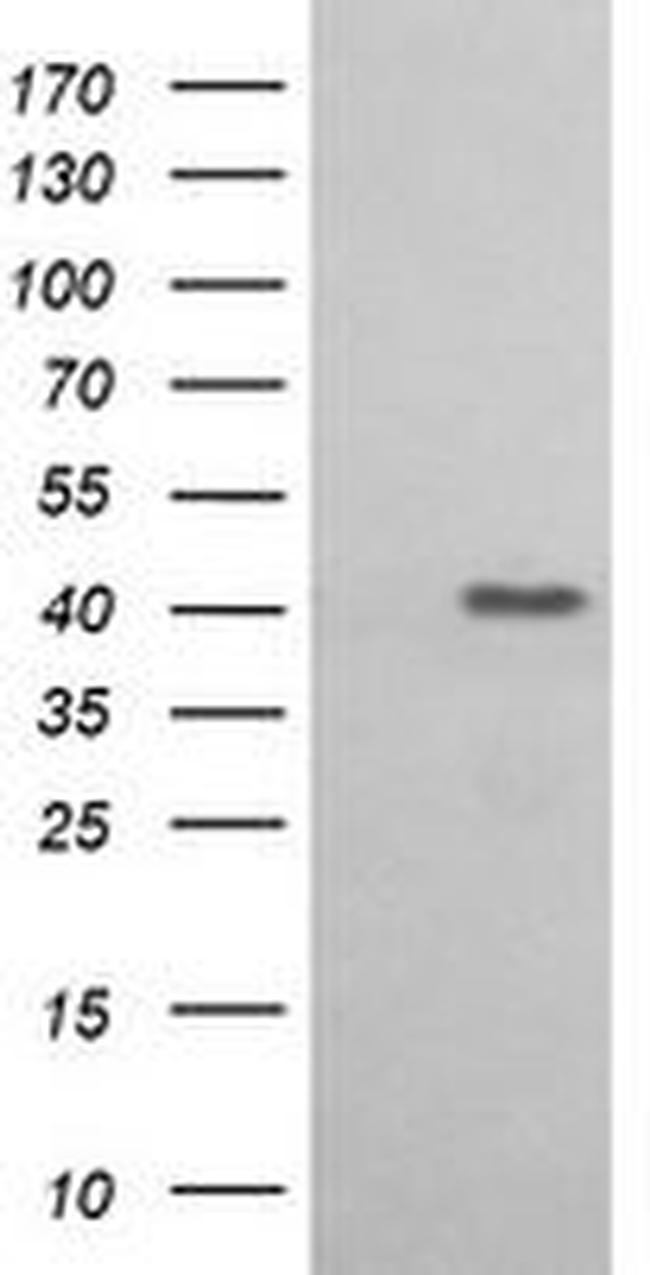 ACAA2 Antibody in Western Blot (WB)