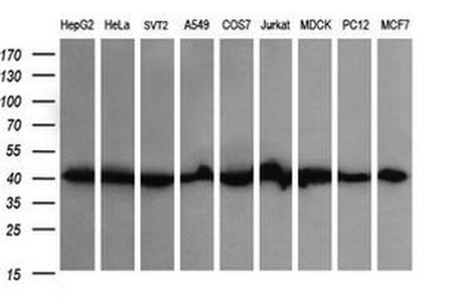 ACAA2 Antibody in Western Blot (WB)