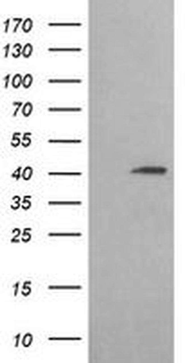 ACAA2 Antibody in Western Blot (WB)