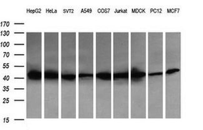 ACAA2 Antibody in Western Blot (WB)