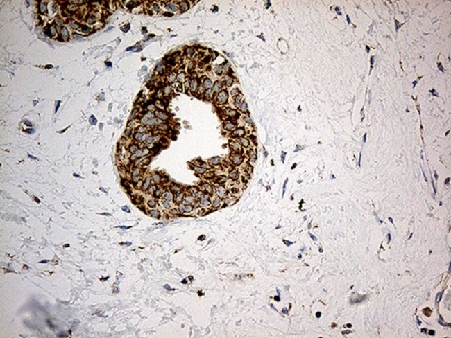 ACAD9 Antibody in Immunohistochemistry (Paraffin) (IHC (P))