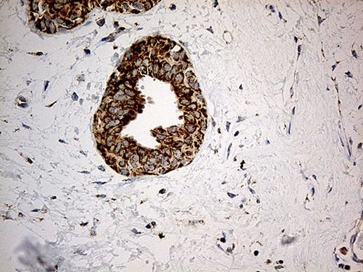 ACAD9 Antibody in Immunohistochemistry (Paraffin) (IHC (P))