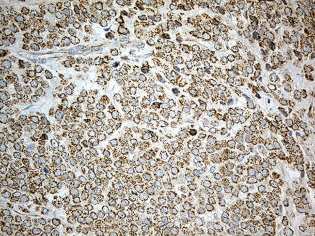 ACAD9 Antibody in Immunohistochemistry (Paraffin) (IHC (P))