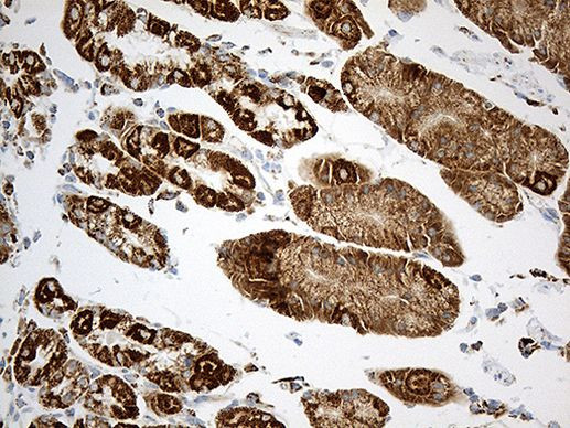 ACADM Antibody in Immunohistochemistry (Paraffin) (IHC (P))