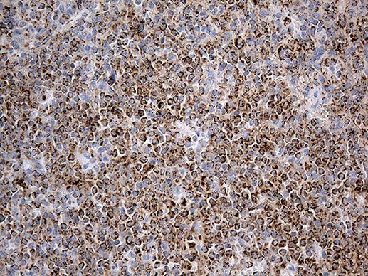 ACADM Antibody in Immunohistochemistry (Paraffin) (IHC (P))