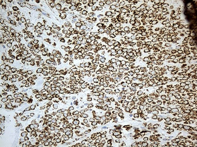 ACADM Antibody in Immunohistochemistry (Paraffin) (IHC (P))