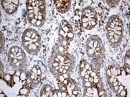 ACADM Antibody in Immunohistochemistry (Paraffin) (IHC (P))