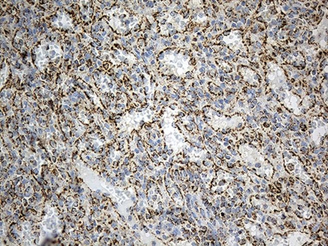 ACADM Antibody in Immunohistochemistry (Paraffin) (IHC (P))