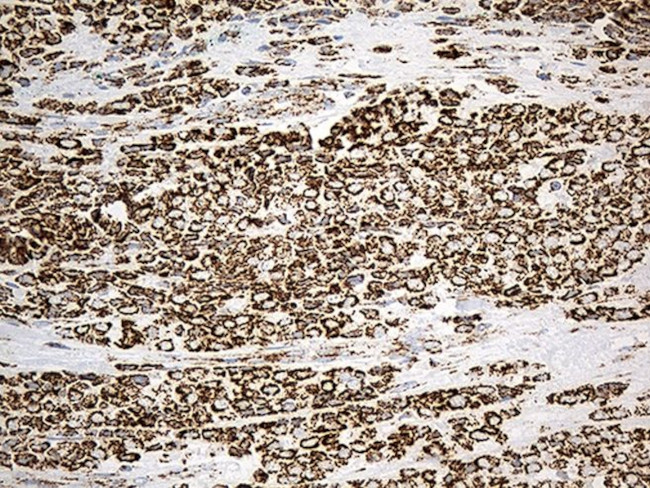 ACADM Antibody in Immunohistochemistry (Paraffin) (IHC (P))