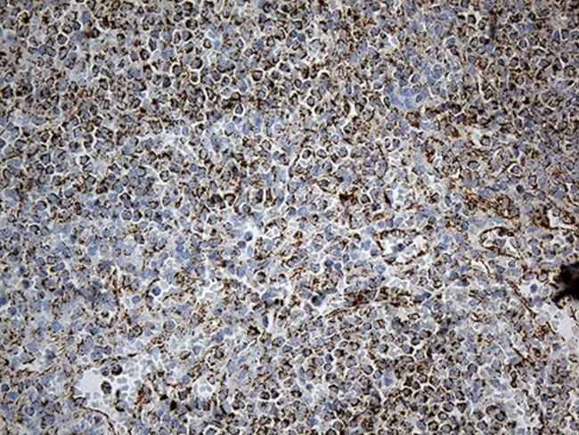 ACADM Antibody in Immunohistochemistry (Paraffin) (IHC (P))