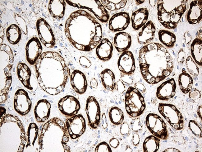 ACADM Antibody in Immunohistochemistry (Paraffin) (IHC (P))