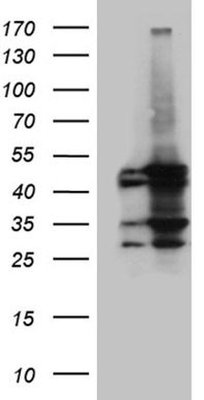 ACADM Antibody in Western Blot (WB)