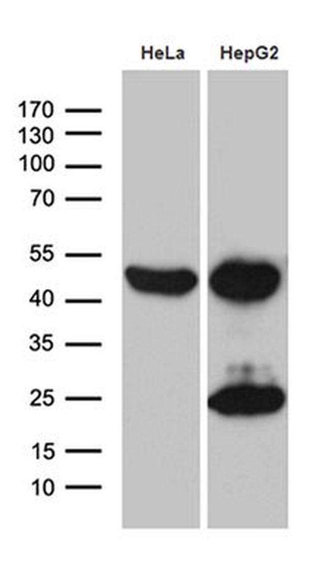 ACADM Antibody in Western Blot (WB)