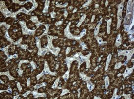 ACADS Antibody in Immunohistochemistry (Paraffin) (IHC (P))