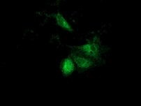 ACAT2 Antibody in Immunocytochemistry (ICC/IF)