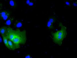 ACAT2 Antibody in Immunocytochemistry (ICC/IF)