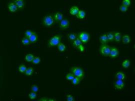 ACAT2 Antibody in Immunocytochemistry (ICC/IF)