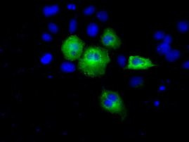 ACAT2 Antibody in Immunocytochemistry (ICC/IF)